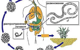 Почему постоянно появляются глисты