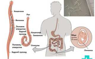 Цикл развития острицы схема